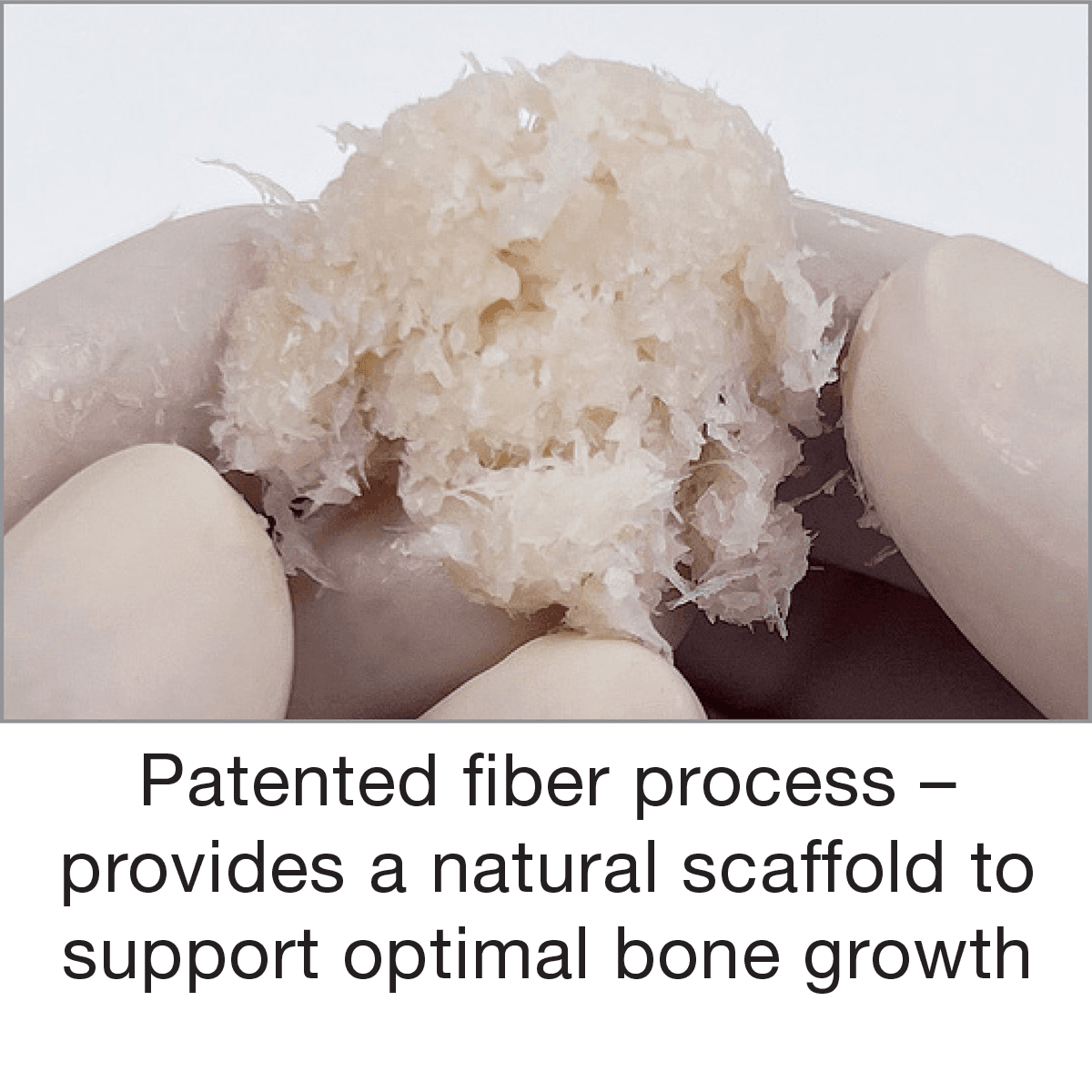 Salvin FiberPutty™ – 100% Allograft Putty in a Syringe
