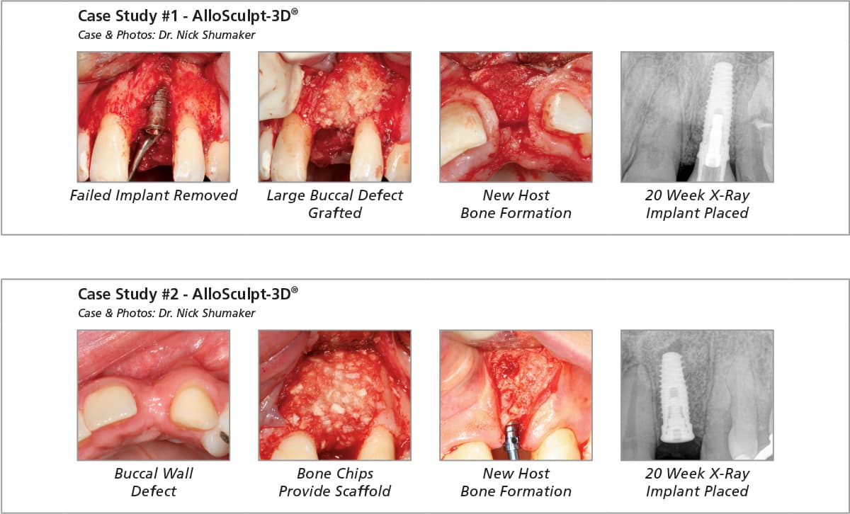 Salvin AlloSculpt-3D® - Inductive/Conductive - 0.5cc