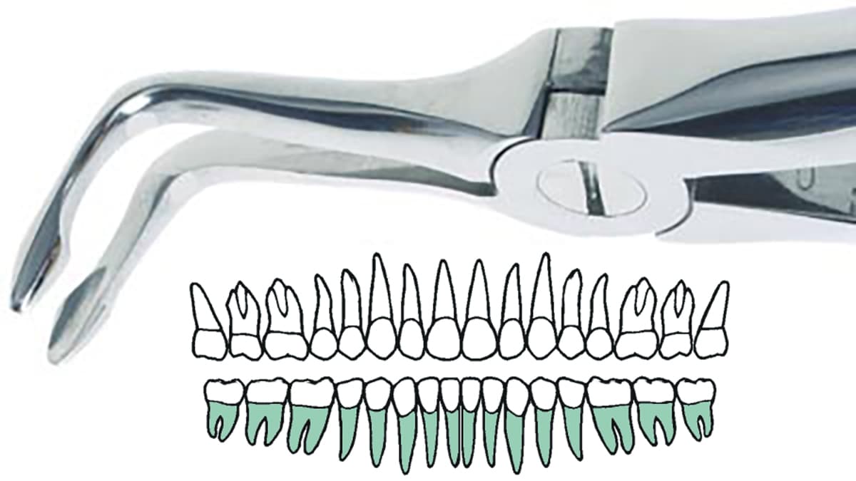 Salvin Bernard Bayonet Atraumatic Extraction Forcep #146