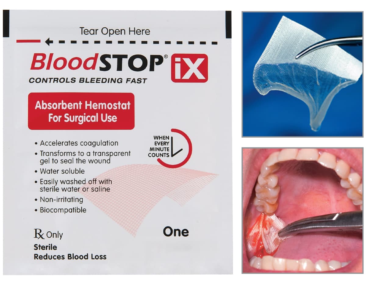 Bloodstop IX Hemostatic Gauze 2"x 2" Box of 12