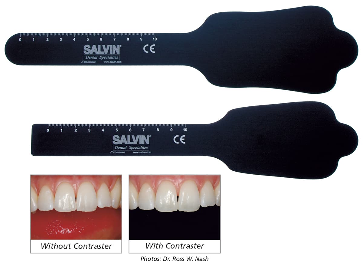 1 Large & 1 Small Salvin Photo Contraster Set