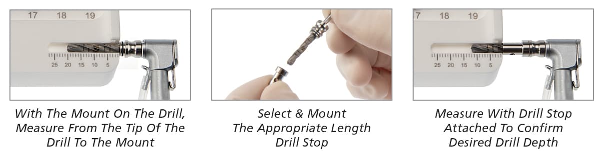 Salvin Universal Drill Stop Kit