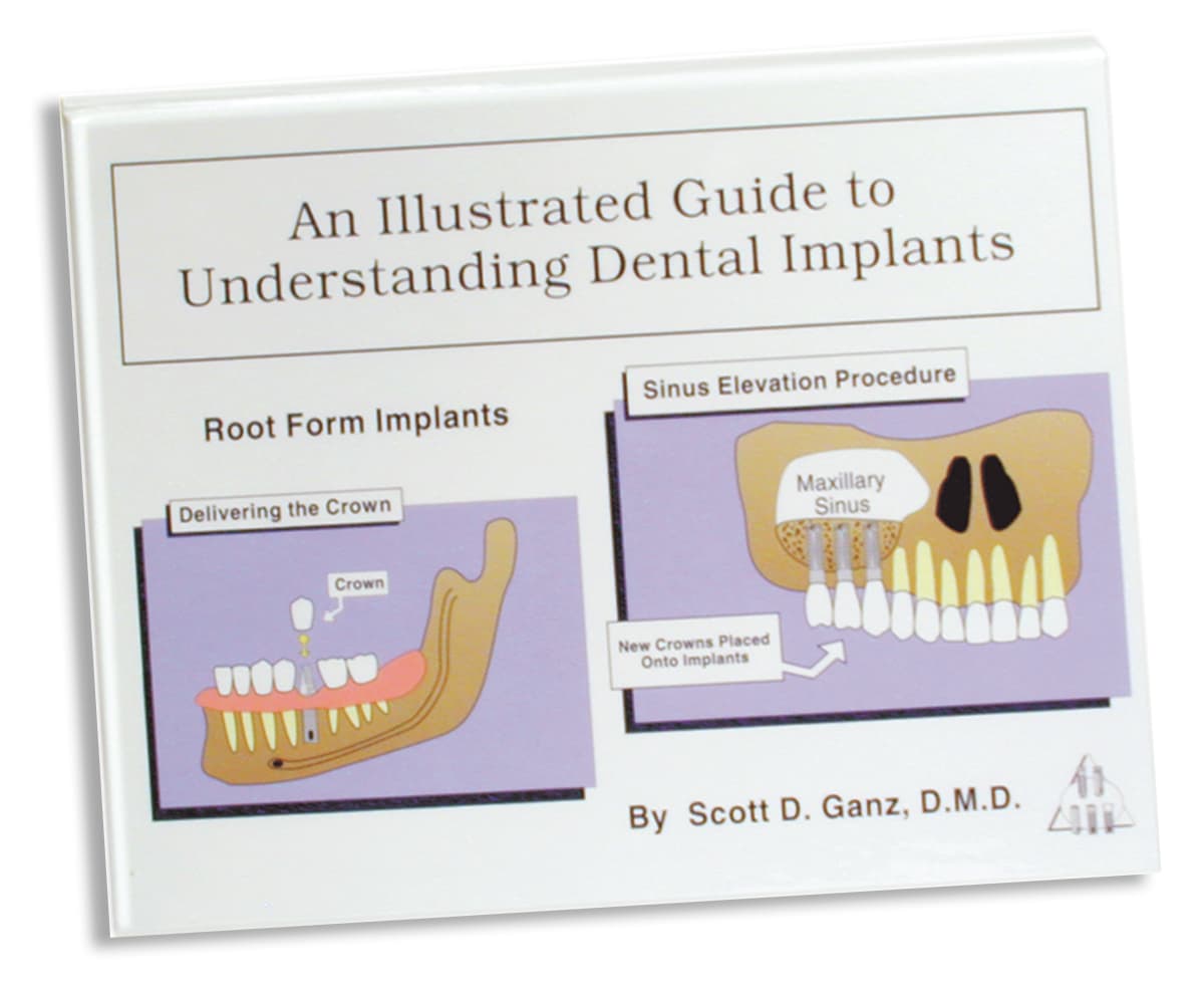 Illustrated Implant Guide By Dr. Scott Ganz                                                                  