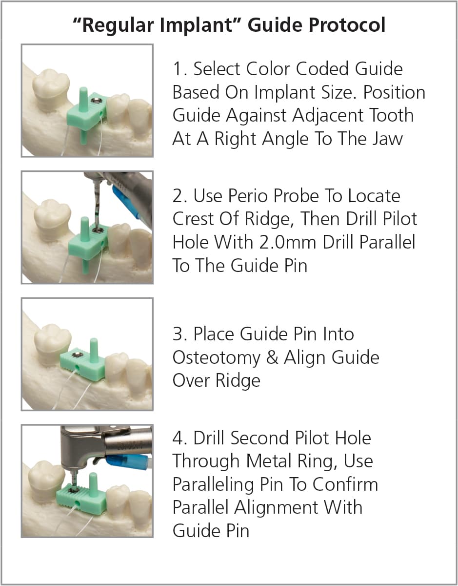 Salvin Implant Guide Set For Standard Implants