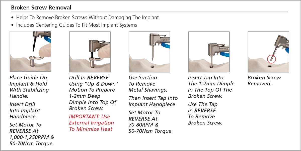Salvin Implant Rescue Kit                                                                                    