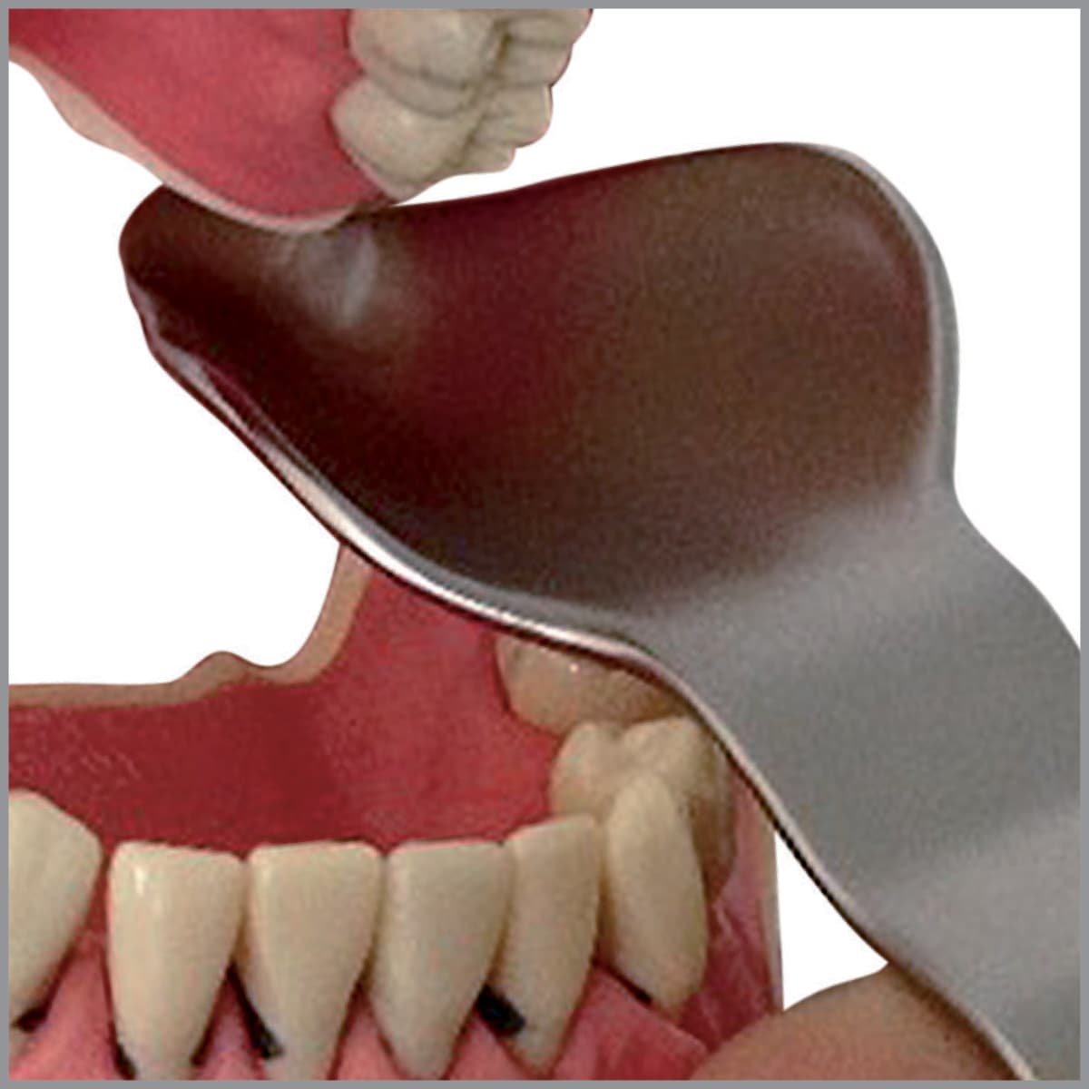 Salvin Laster Third Molar Retractor