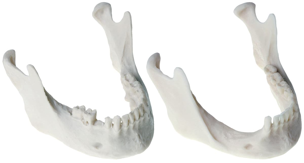Set Of Both Mandible Models