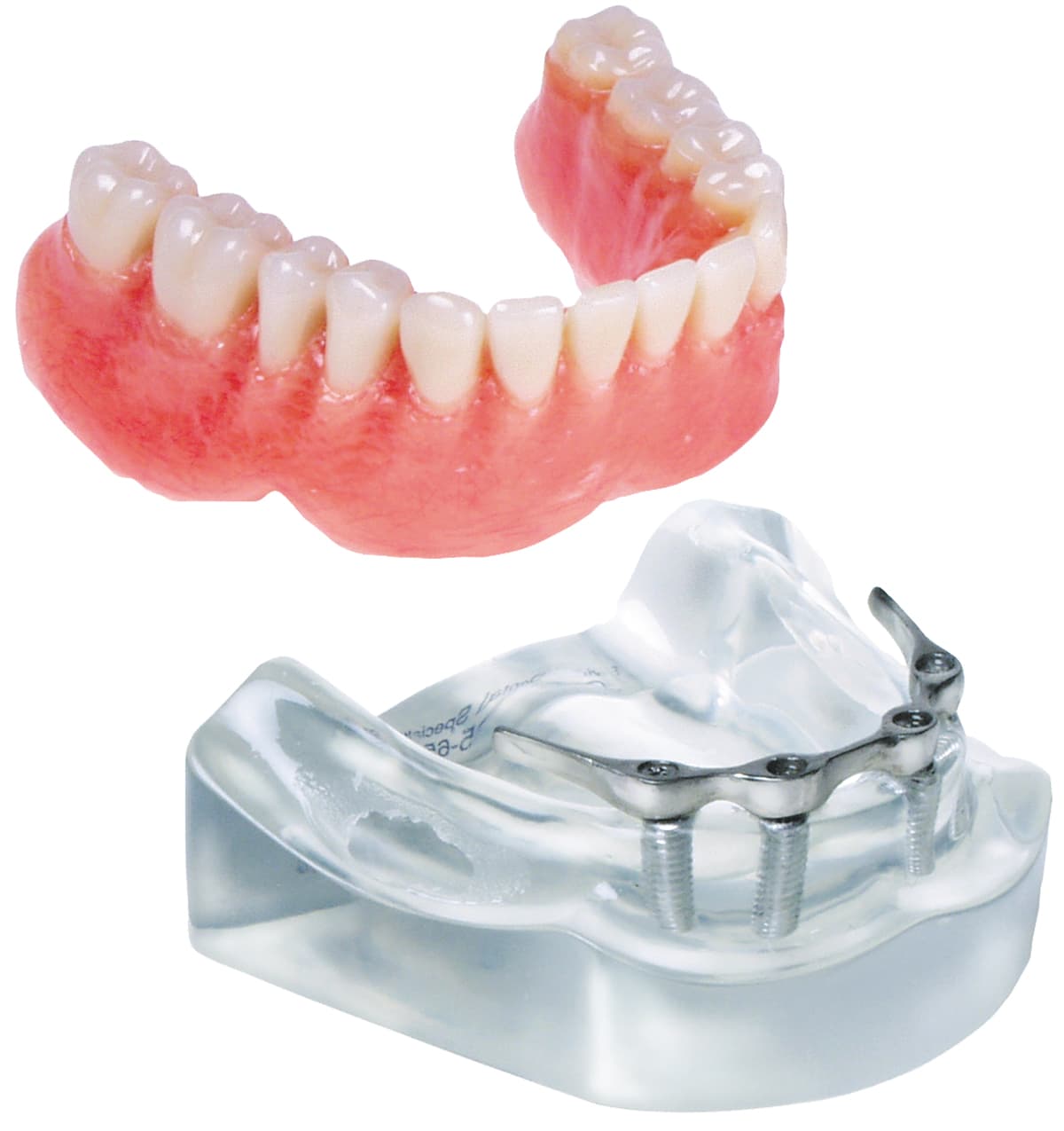 Implant Model - 4 Implant Hader Clip Bar Lower Overdenture