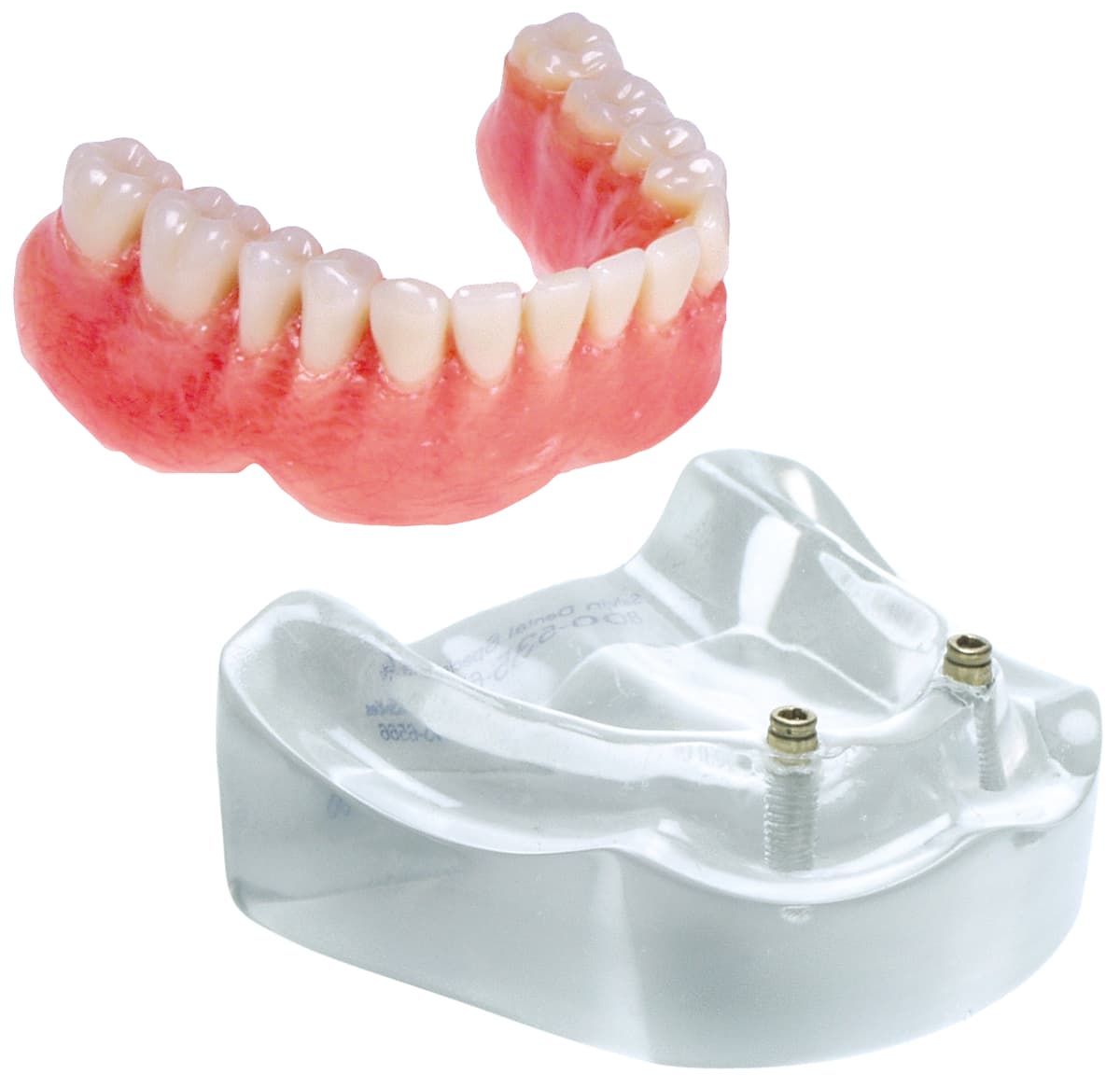Implant Model - 2 Implant Locator™ Abutment Lower Overdenture