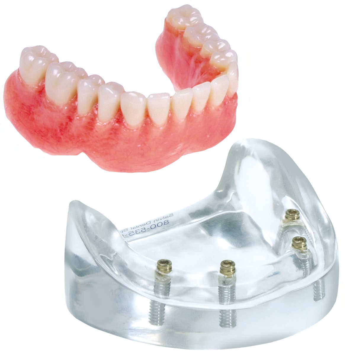 Implant Model - 4 Implant Locator™ Abutment Lower Overdenture