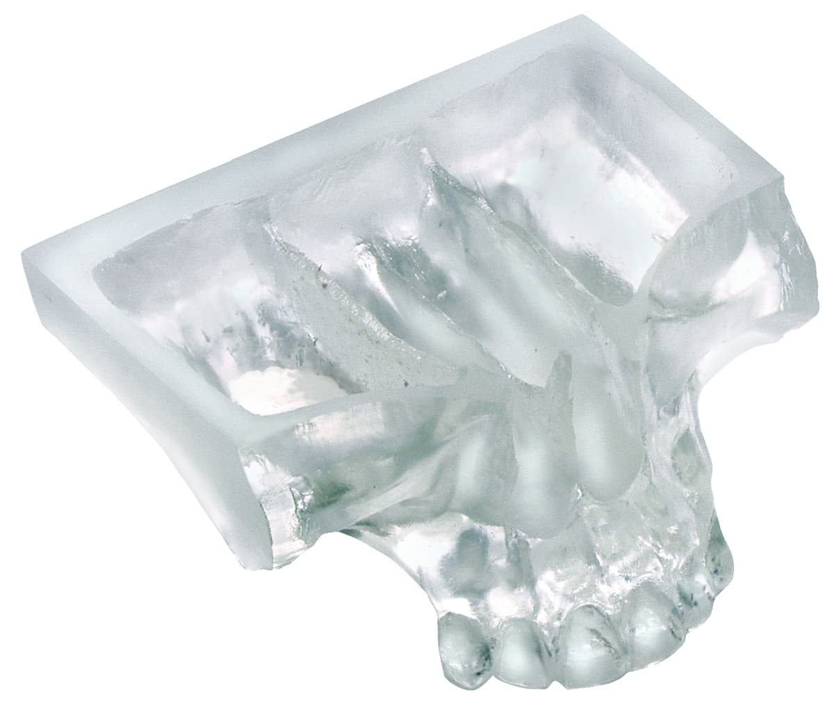 Clear Model Showing Sinus Graft