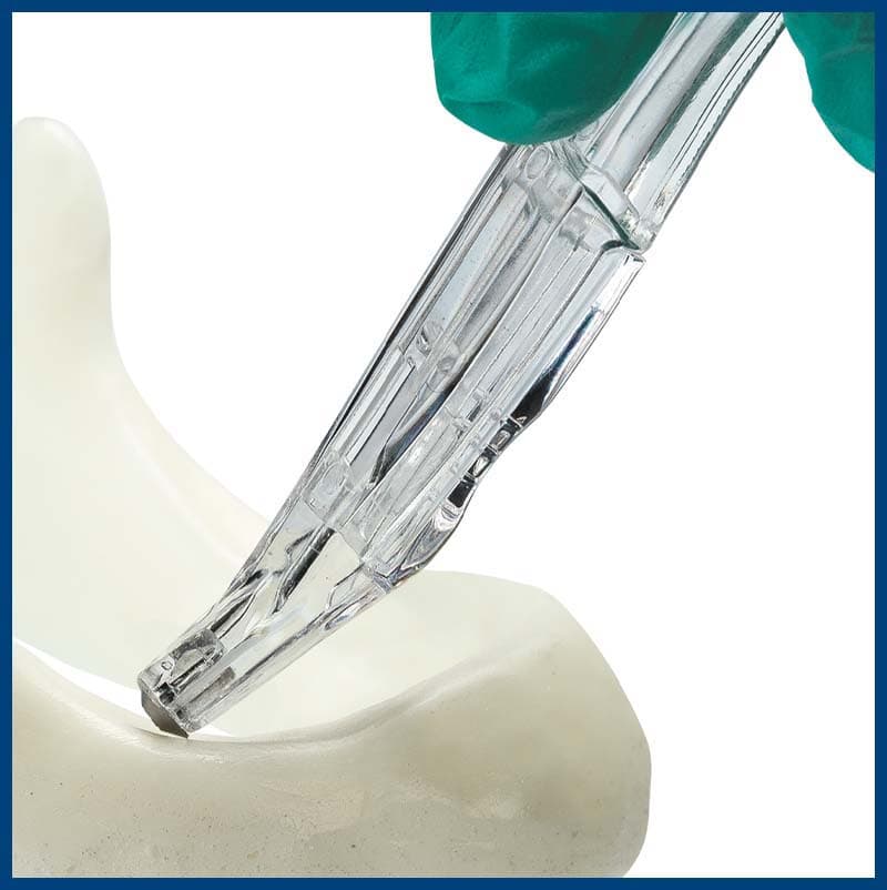 OsseoScrape™ Angled Bone Scraper - Box of 5