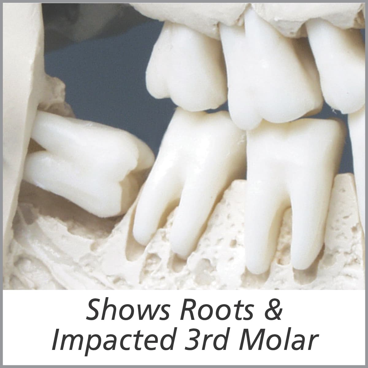 Extractable Teeth Skull Model