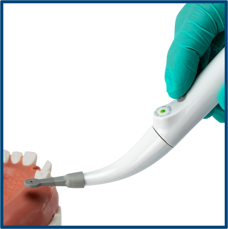 Spotter Smart Implant Detector                                                                               