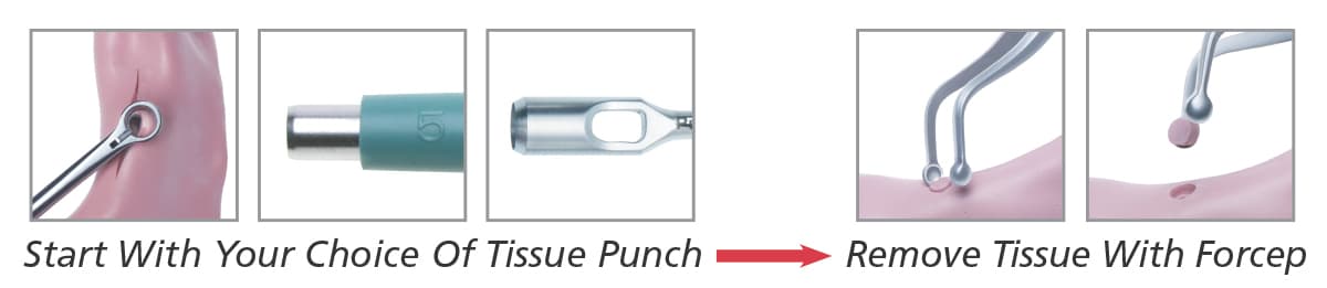 Salvin Tissue Punch Forcep
