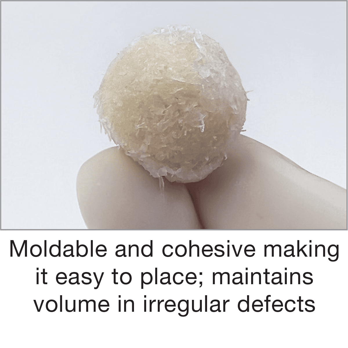Salvin FiberPutty™ – 100% Allograft Putty in a Syringe