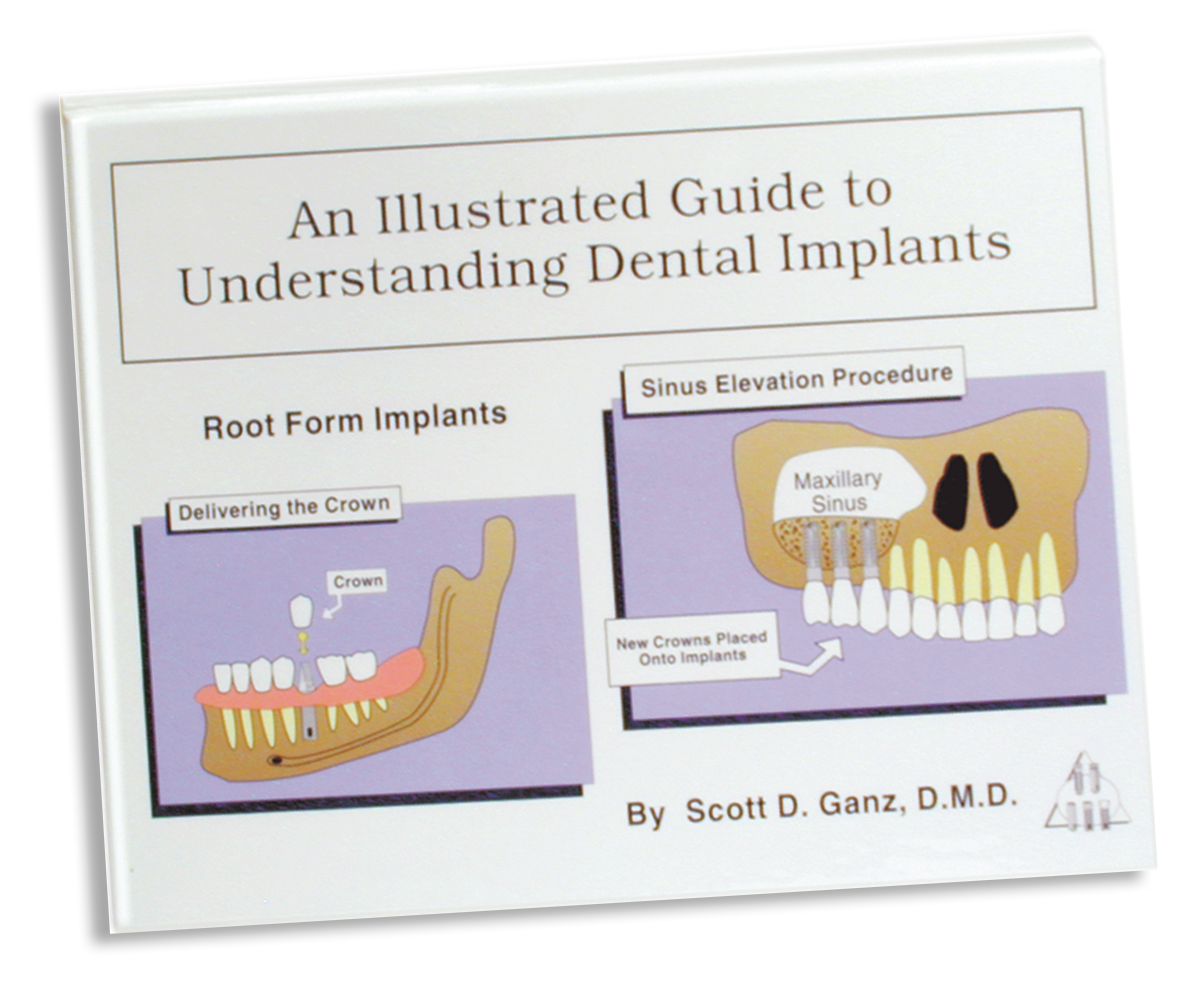 The Ultimate Guide to Dental Implants Everything You Need to