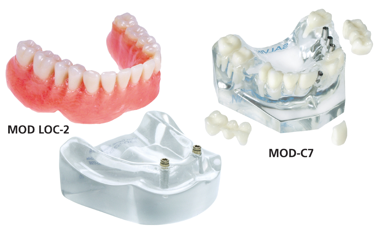 MOD-SPECIAL-LOC2-C7-©Salvin-Dental-Specialties-Product-Image